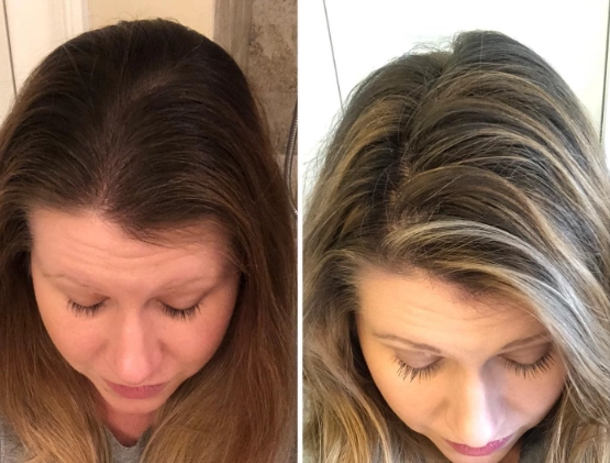The Truth About Hair Dye: Health Risks, Safer Choices & Professional Advice