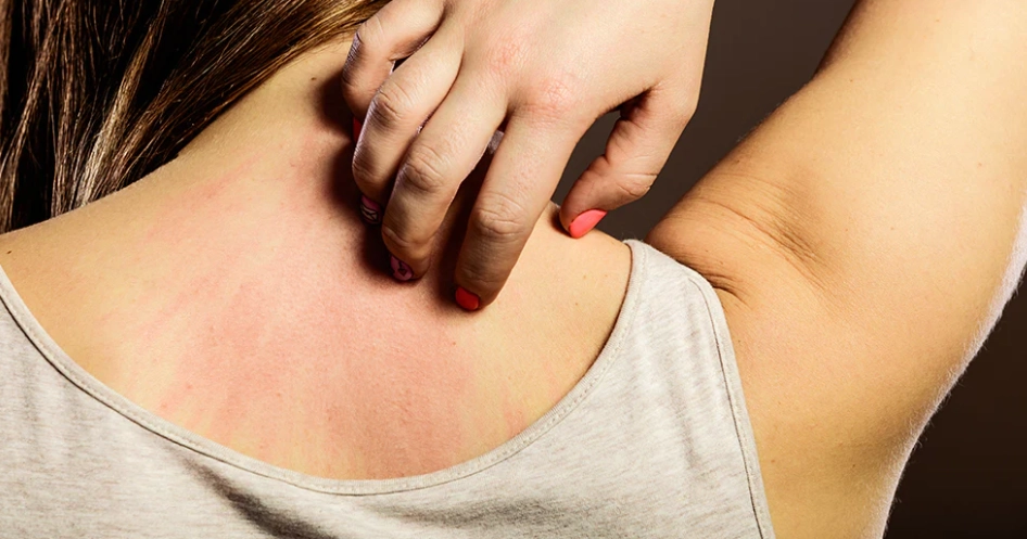 Can Modal Fabric Cause Skin Irritation? A Dermatologist's Guide